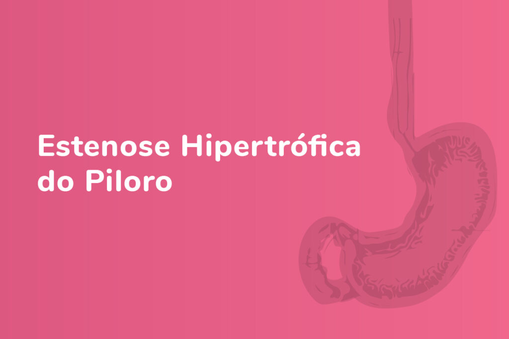 estenose hipertrófica do piloro