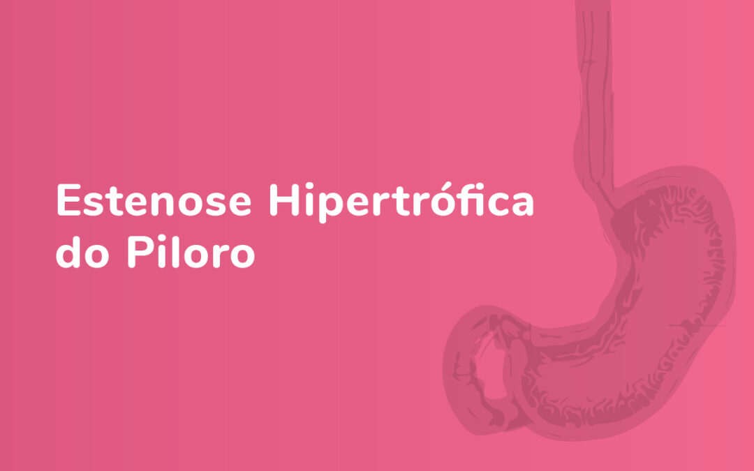 Estenose hipertrófica do piloro: diagnóstico e tratamento precoce